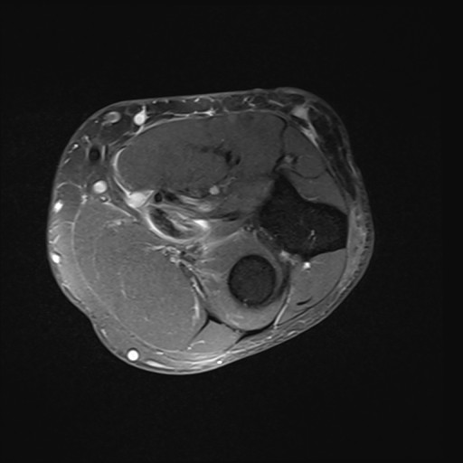 Click on the Serie image to view the images of Wieszt, Gnter